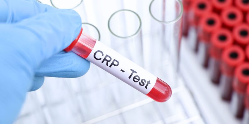 CRP Testi Nedir?