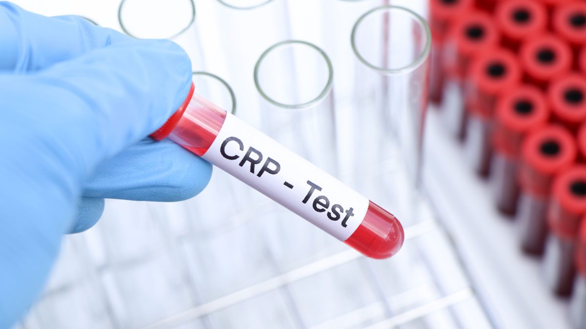 CRP Testi Nedir?
