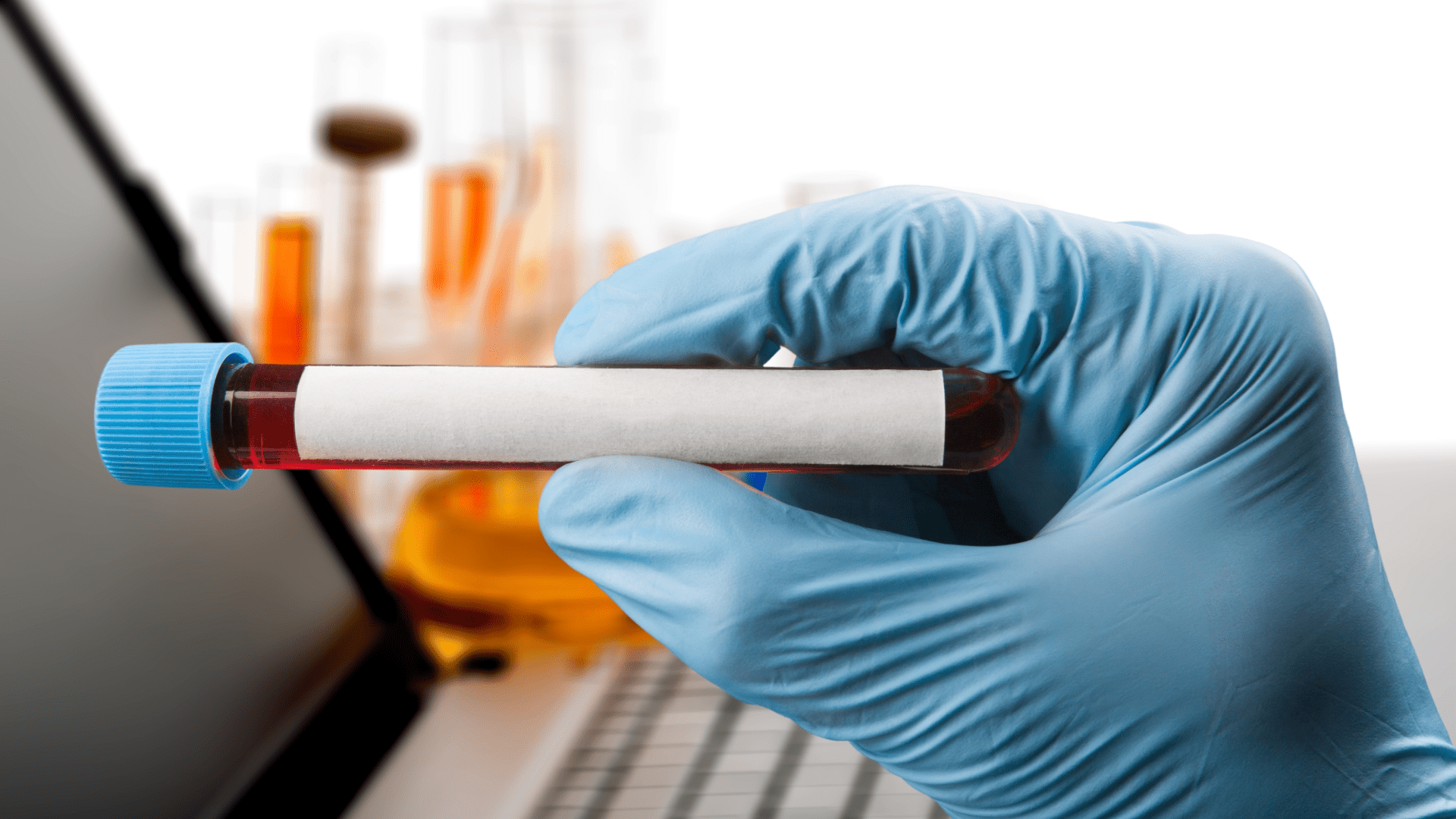 Eozinofil Katyonik Protein (ECP) Testi Nedir?