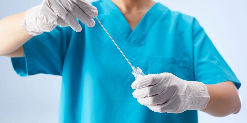 Erkeklerde HPV Testi Nasıl Yapılır?