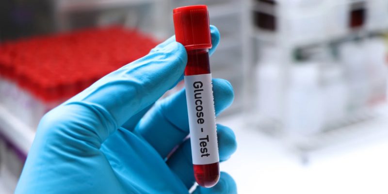 Glukoz Testi Nedir?