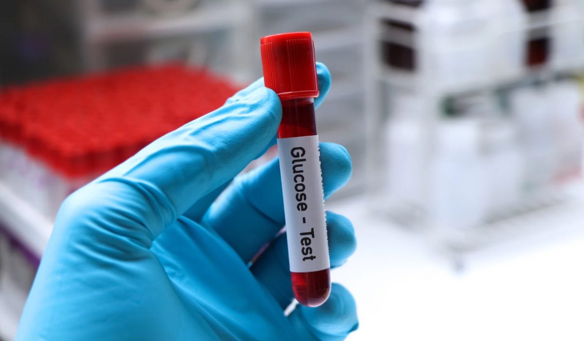 Glukoz Testi Nedir?