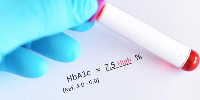 HbA1c Testi Nedir?