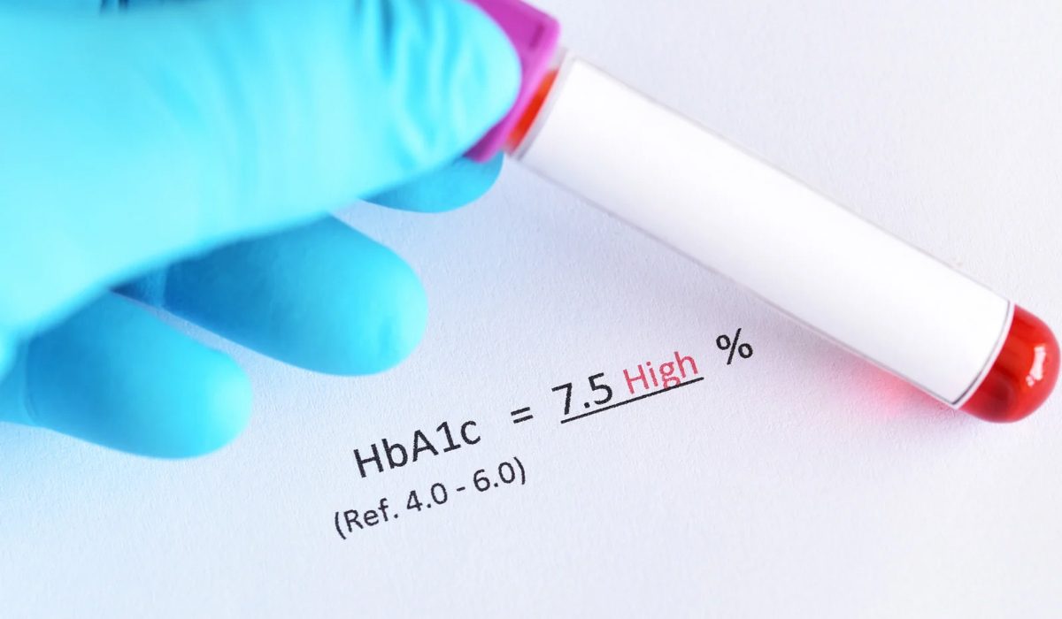 HbA1c Testi Nedir?