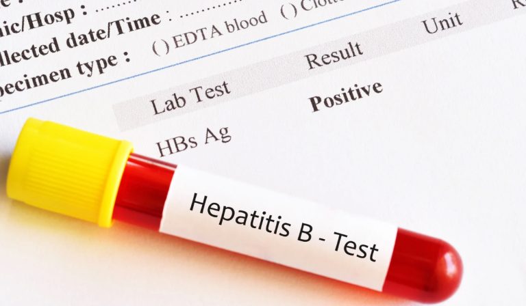 HbsAg Testi