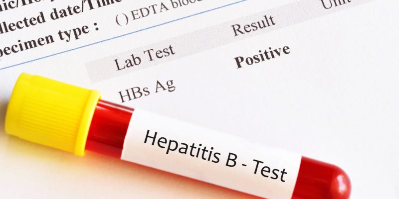 HbsAg Testi Nedir?