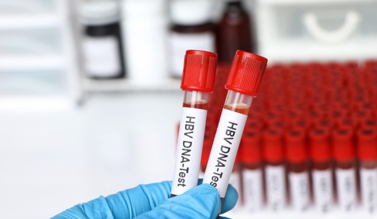 HBV DNA Testi