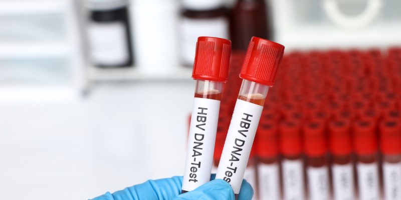 HBV DNA Testi Nedir?