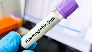 Hemoglobin (HGB)