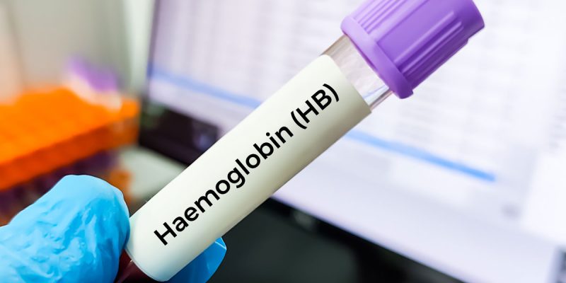 Hemoglobin (HGB) Nedir?