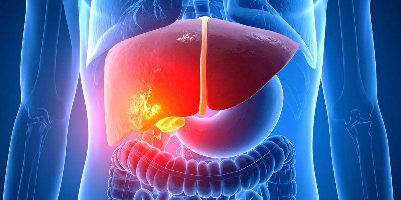 Hepatit A Belirtileri Nelerdir?