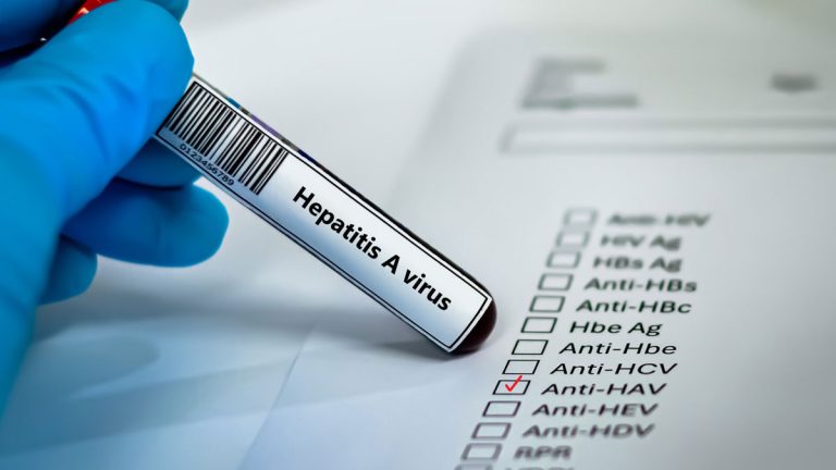 Hepatit A Nasıl Bulaşır?