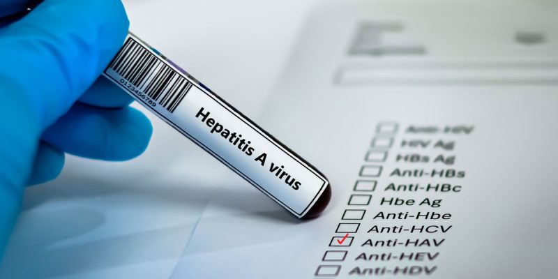 Hepatit A Nasıl Bulaşır?