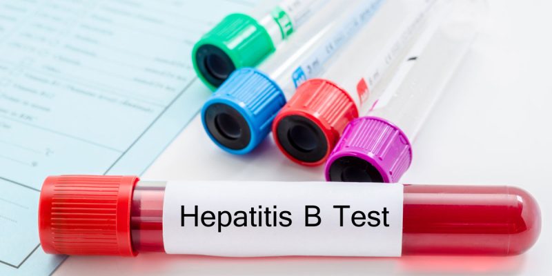 Hepatit B Testi Nedir?