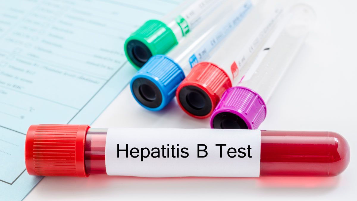 Hepatit B Testi Nedir?