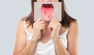 HIV Ağız Belirtileri Nelerdir?