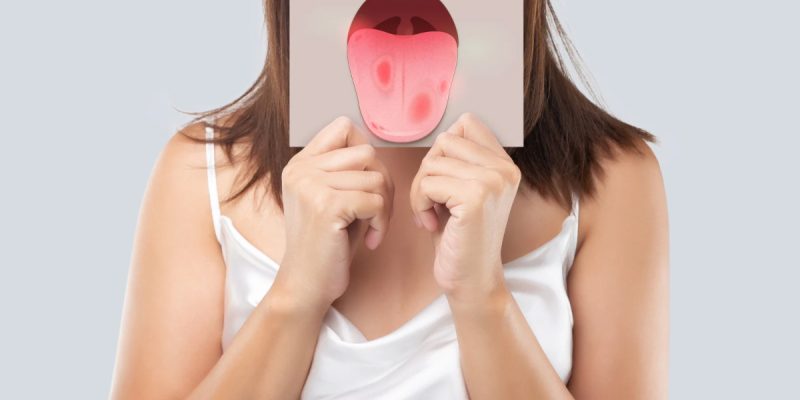 HIV Ağız Belirtileri Nelerdir?