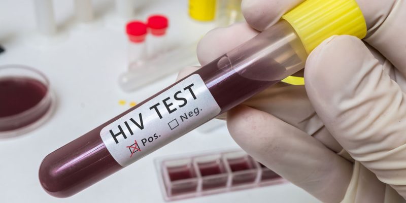 HIV Combo Testi Nedir?