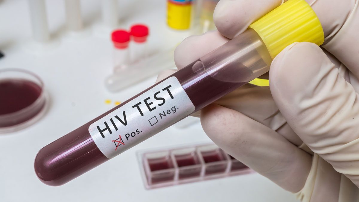 HIV Combo Testi Nedir?