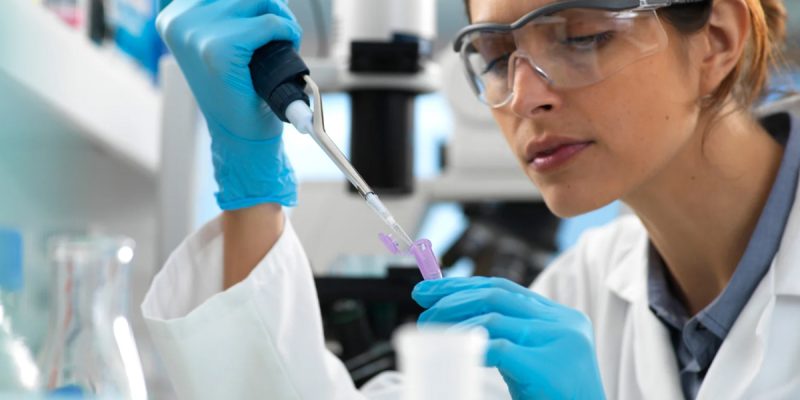 Homosistein Testi Nedir?