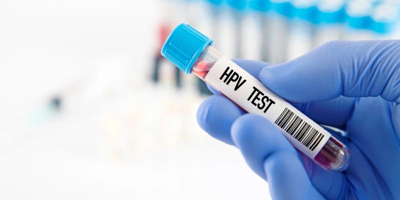 HPV Kan Testinde Çıkar mı?
