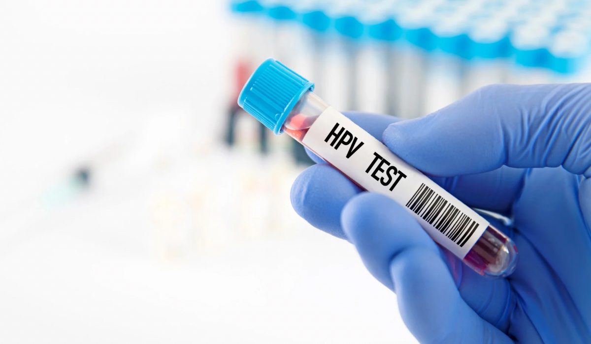 HPV Kan Testinde Çıkar mı?