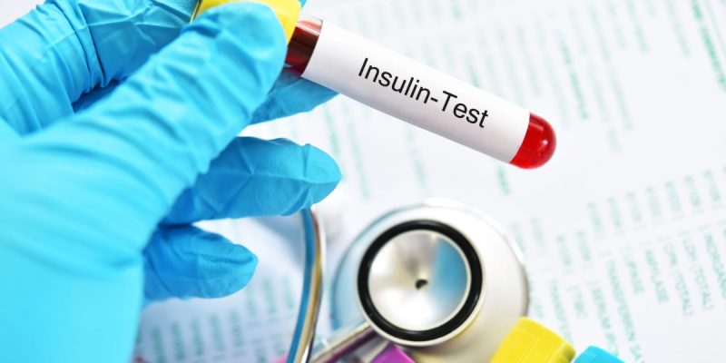 İnsülin Direnci Testi (HOMA-IR) Nedir?