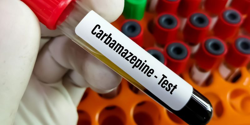 Karbamazapin Testi Nedir?