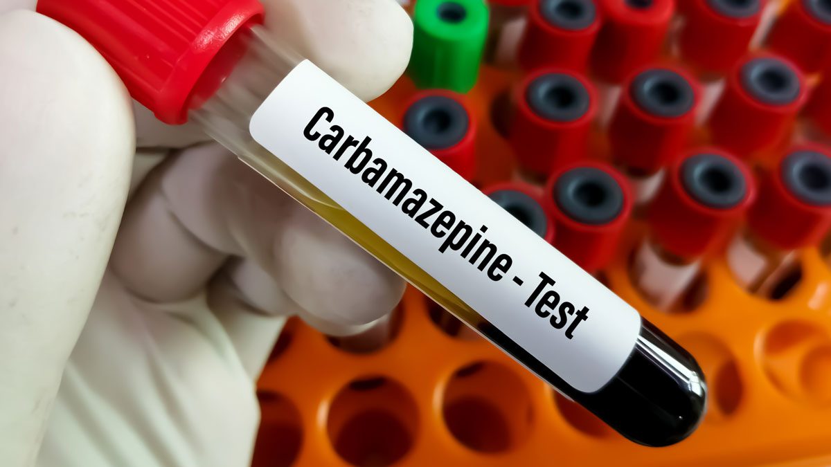 Karbamazapin Testi Nedir?