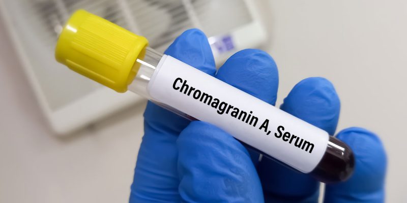 Kromogranin A Testi