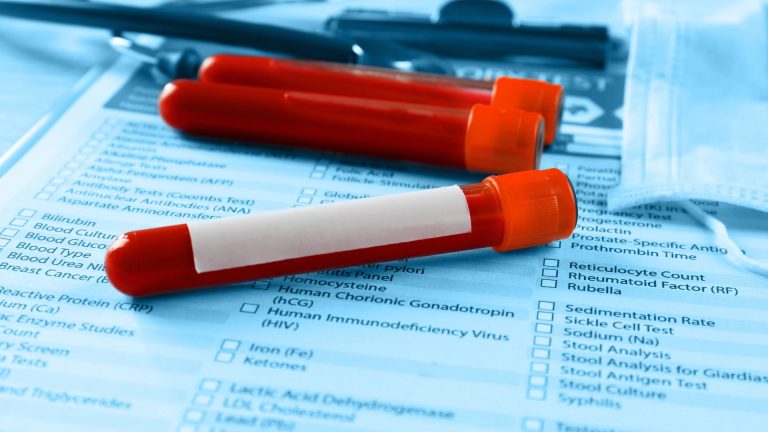 Makroprolaktin Testi