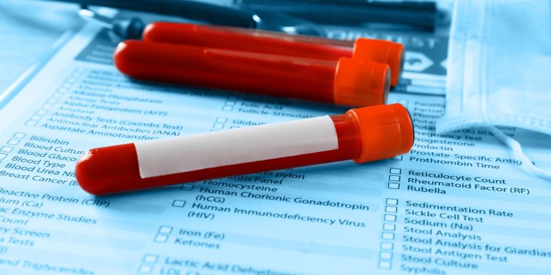 Makroprolaktin Testi