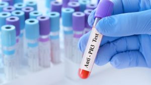 P-ANCA (MPO-ANCA) Testi