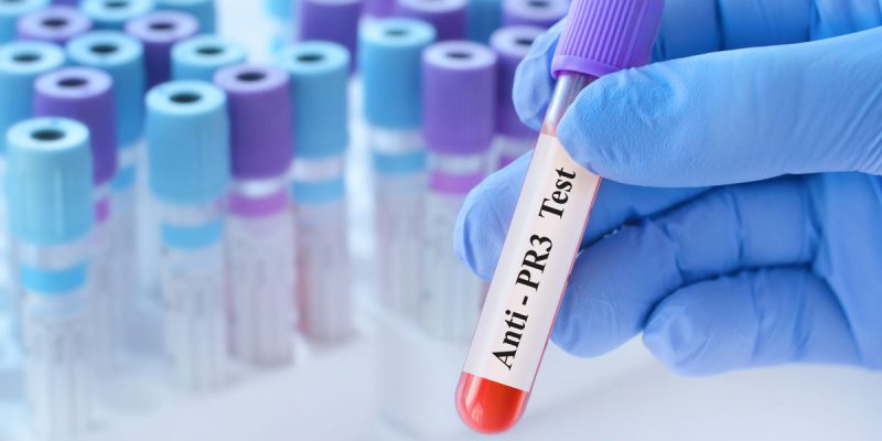 P-ANCA (MPO-ANCA) Testi Nedir?