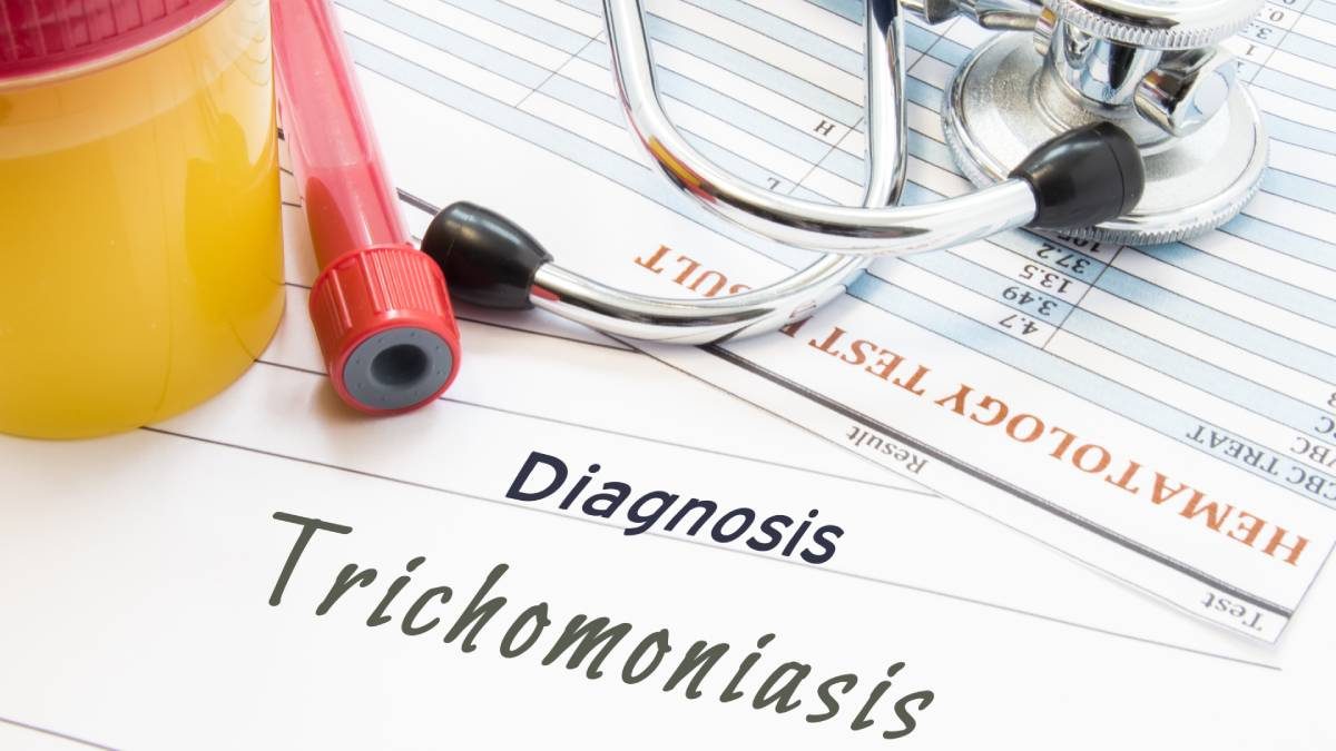 Trichomonas Vaginalis Nedir?