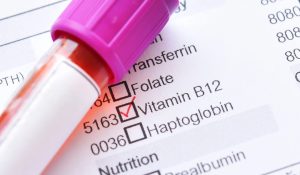Vitamin B12 Testi Nedir?