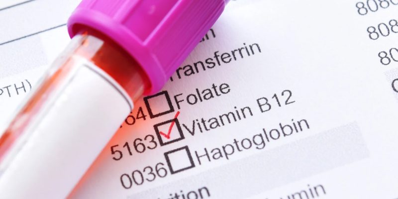 Vitamin B12 Testi Nedir?