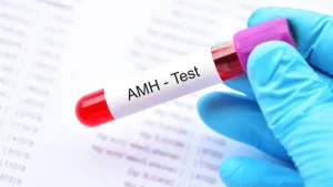 Yumurta Rezervi (AMH) Nedir?