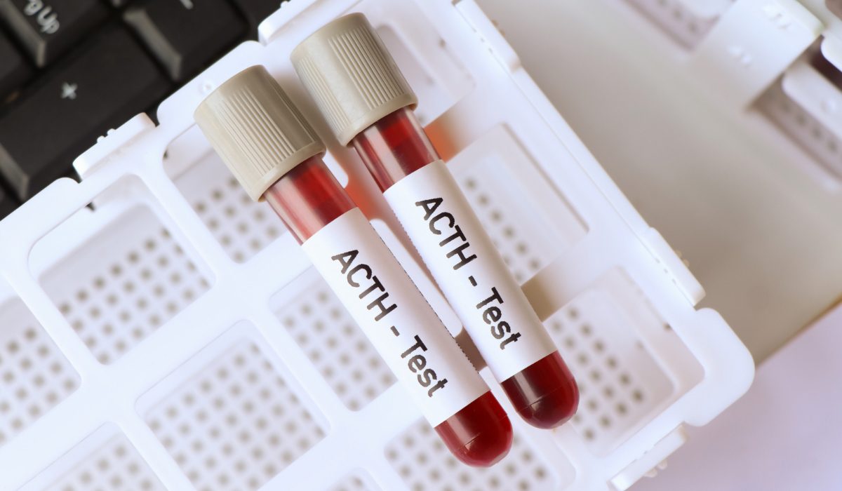 ACTH (Adrenokortikotropik Hormon) Testi Nedir?