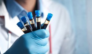 ADH (Vazopressin) Testi Nedir?