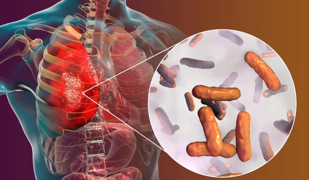 Fırsatçı Enfeksiyonlar Nedir?