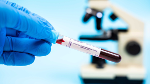 FMF (Ailevi Akdeniz Ateşi) Testi Nedir?