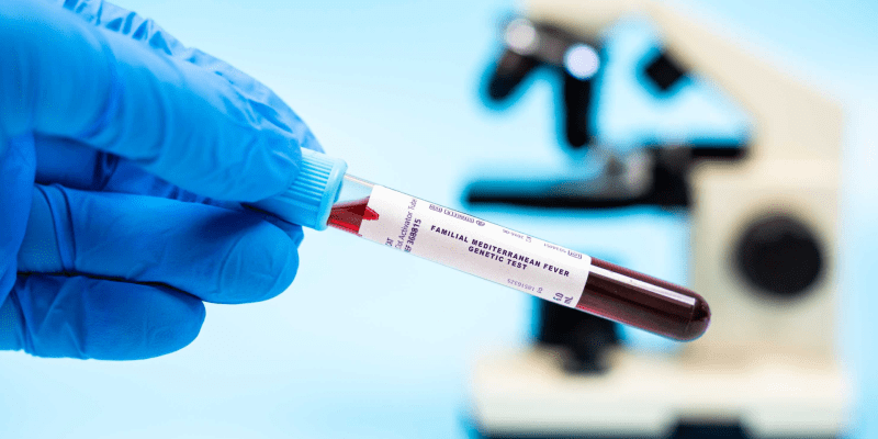 FMF (Ailevi Akdeniz Ateşi) Testi Nedir?