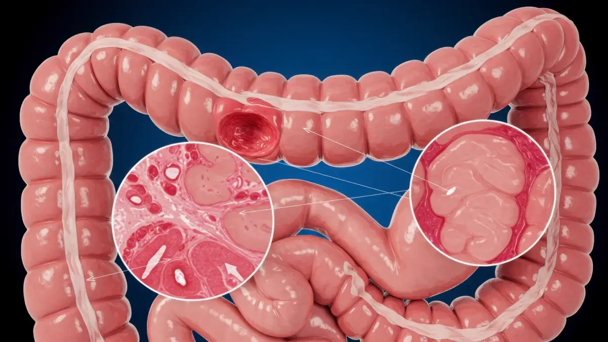 Gaitada Gizli Kan Testi Nedir?