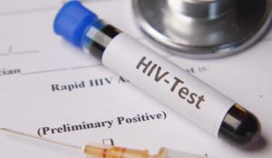HIV Testi Pozitif Ne Demek?
