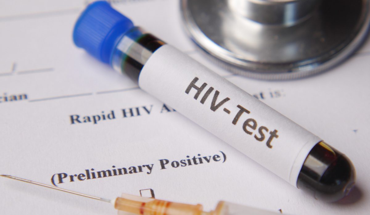 HIV Testi Pozitif Ne Demek?