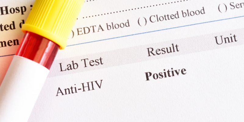 HIV Testi Sonucu