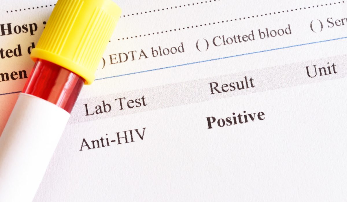 HIV Testi Sonucu: Kesin Sonuç Ne Zaman Çıkar ve Nasıl Yorumlanır?