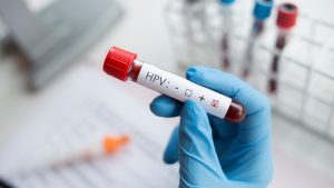 HPV Testi Ne Zaman Yapılmalı?