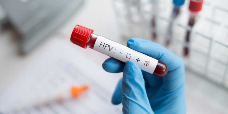 HPV Testi Ne Zaman Yapılmalı?